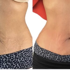 6-treatments-Becking-Wellness